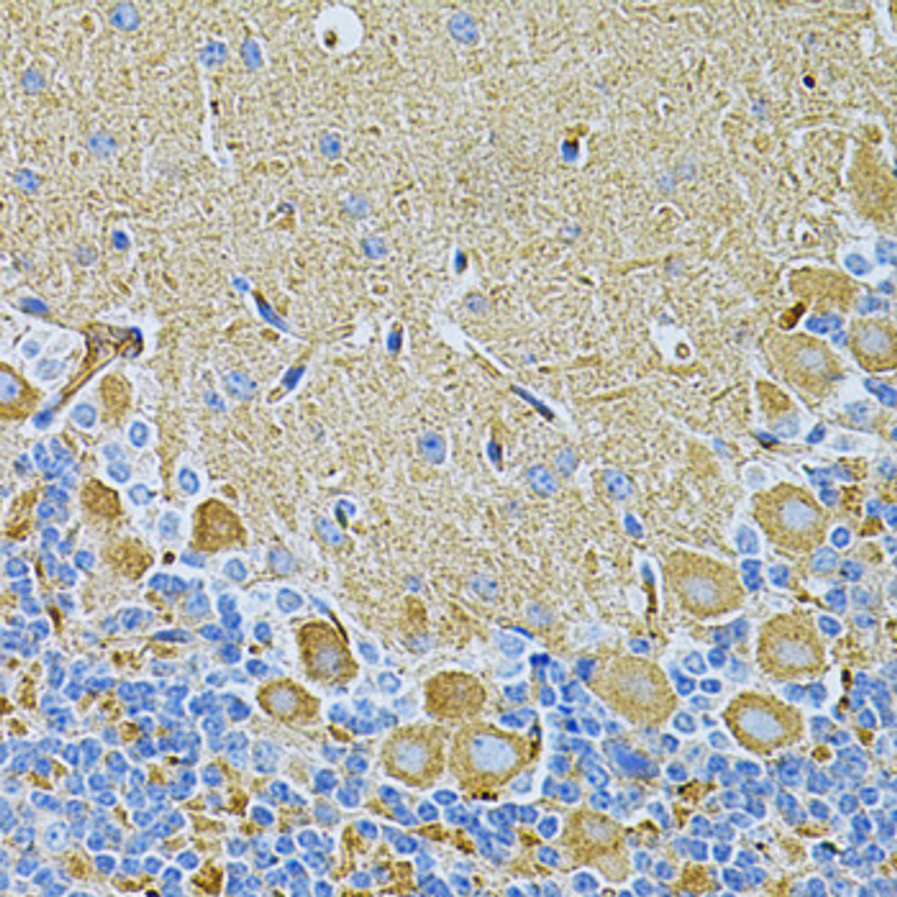 Immunohistochemistry of paraffin-embedded Mouse brain using USP10 Polyclonal Antibody at dilution of  1:100 (40x lens).