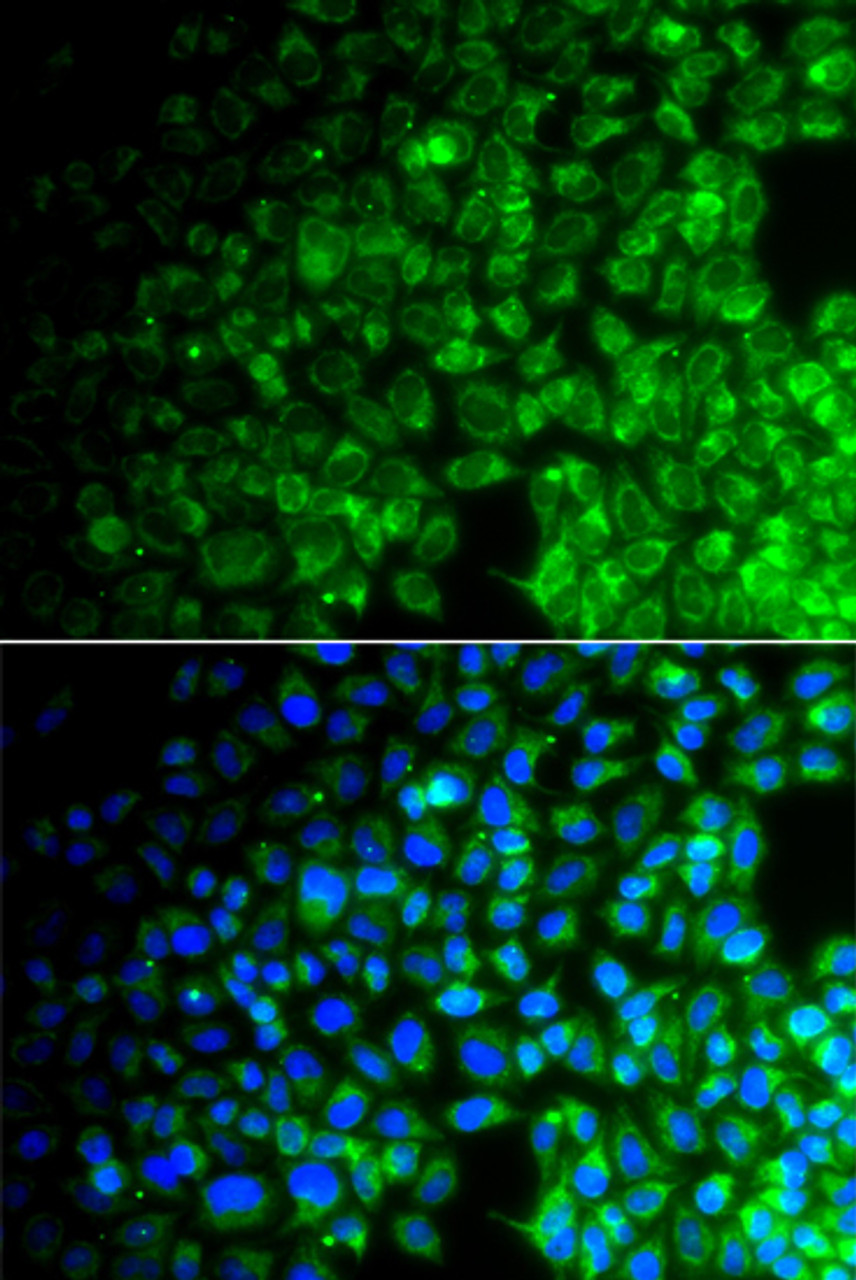Immunofluorescence analysis of A549 cells using USP10 Polyclonal Antibody