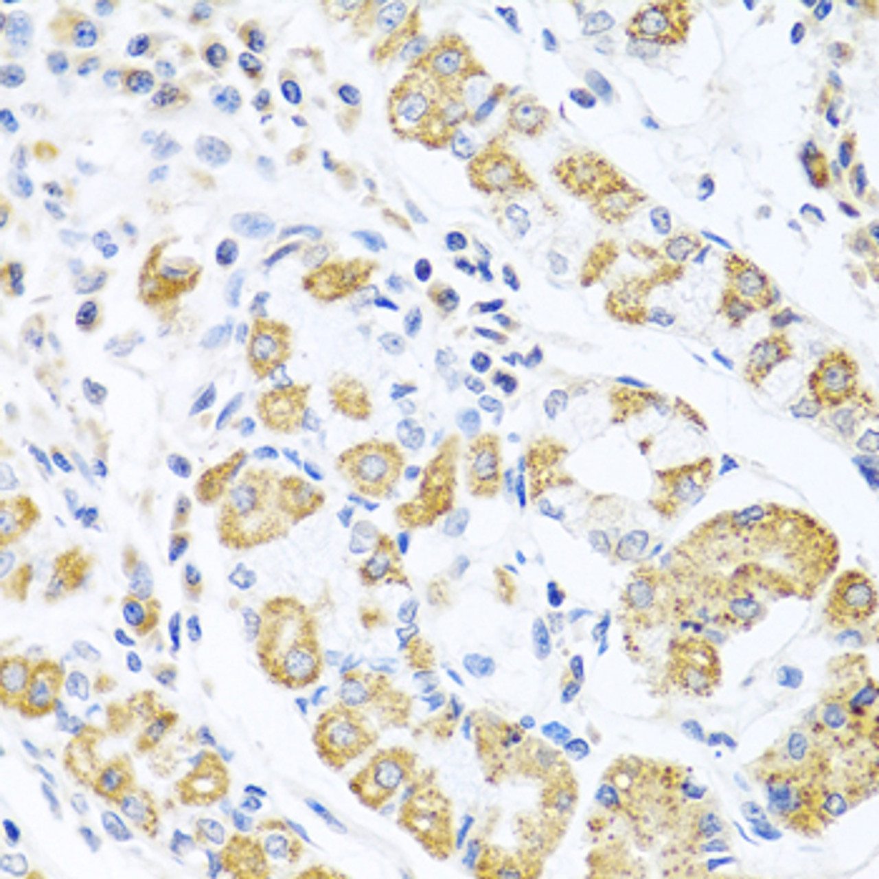 Immunohistochemistry of paraffin-embedded Human stomach using EDIL3 Polyclonal Antibody at dilution of  1:100 (40x lens).