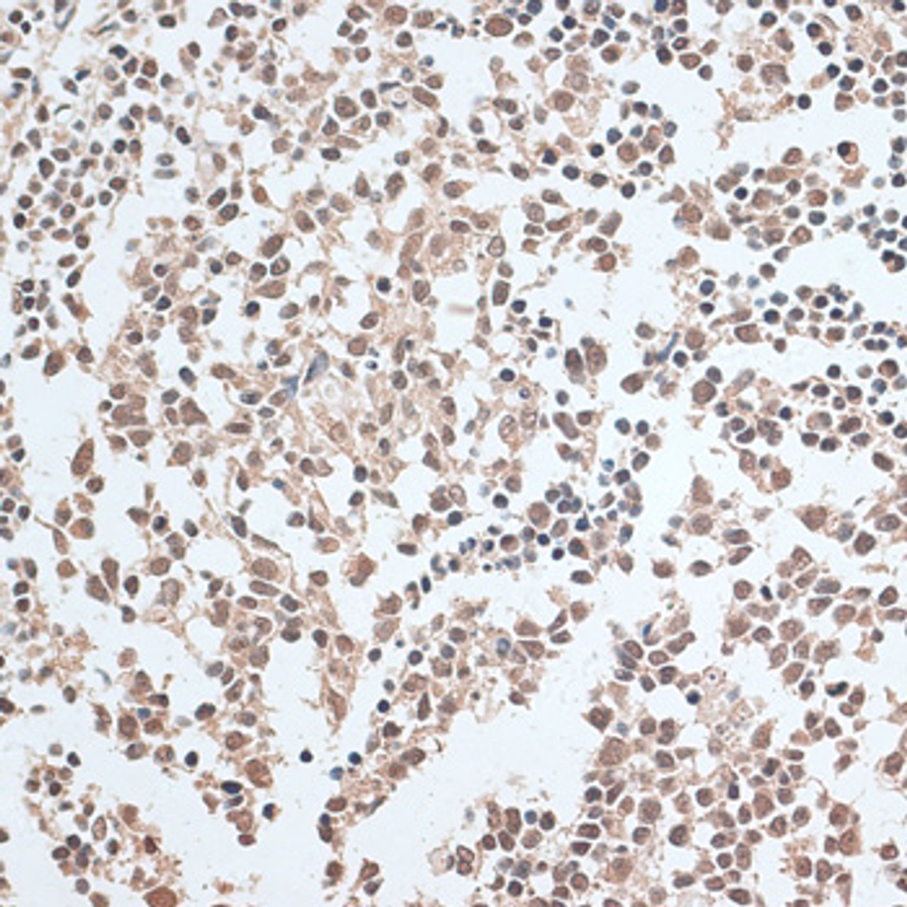 Immunohistochemistry of paraffin-embedded Human tonsil using ZNF346 Polyclonal Antibody at dilution of  1:100 (40x lens).