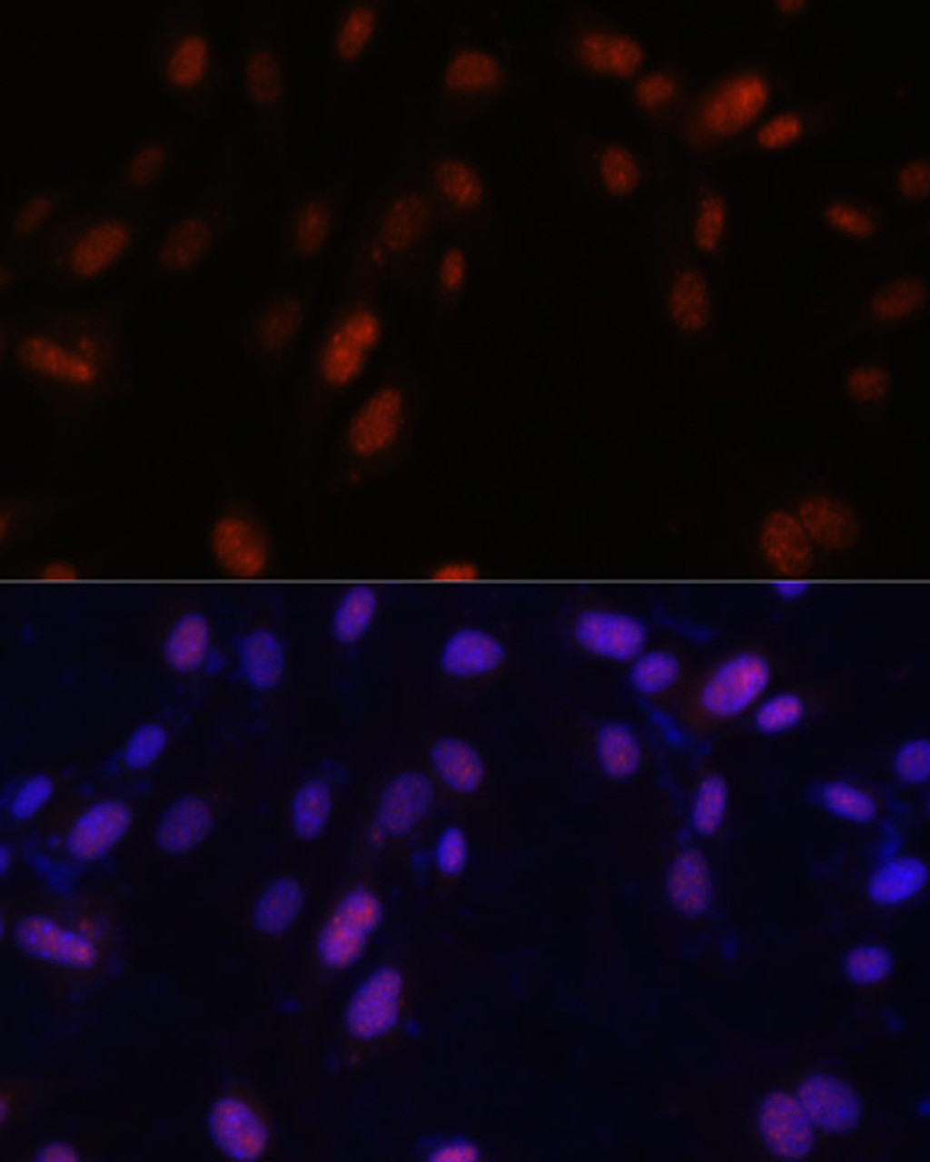 Immunofluorescence analysis of NIH/3T3 cells using ZNF346 Polyclonal Antibody at dilution of  1:100. Blue: DAPI for nuclear staining.