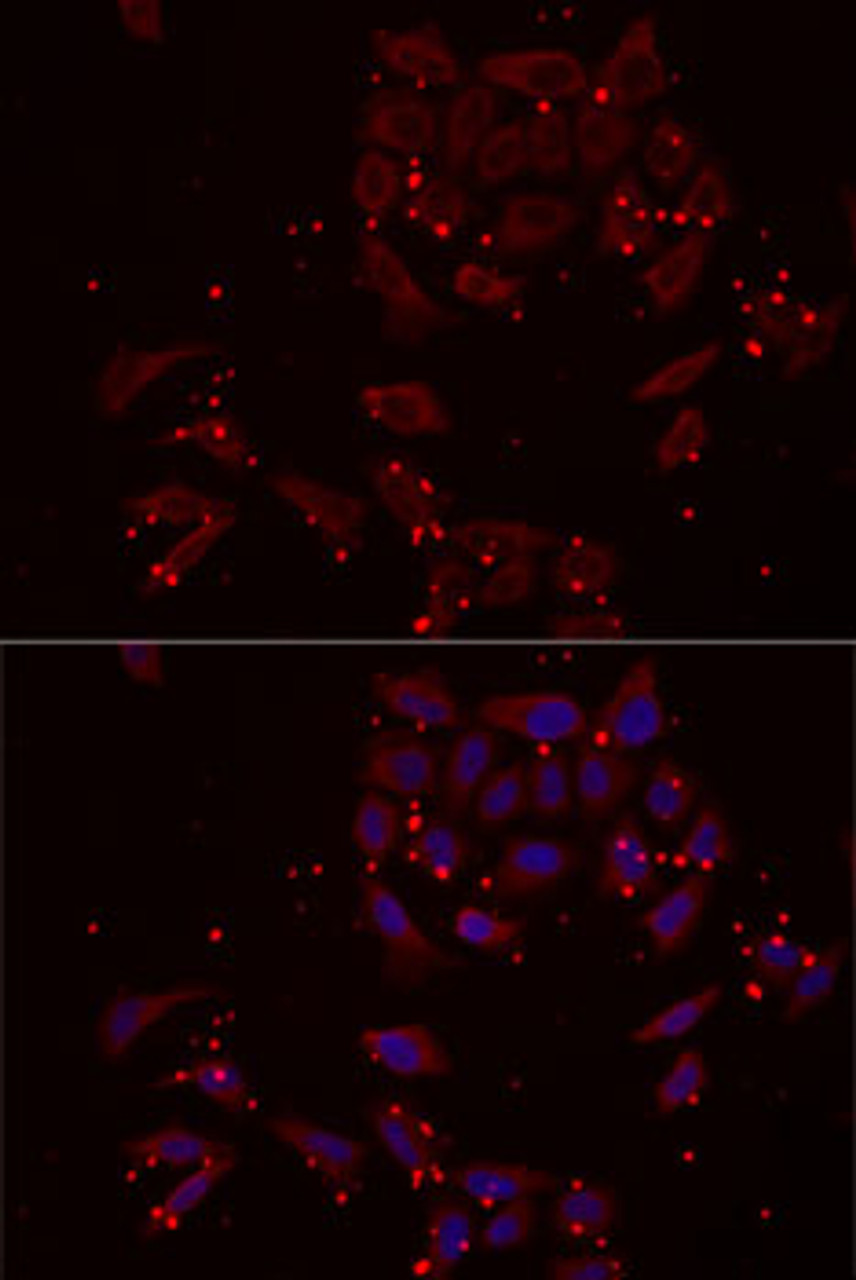 Immunofluorescence analysis of MCF7 cells using NRBF2 Polyclonal Antibody