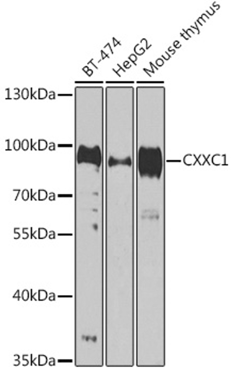 Western blot analysis of extracts of various cell lines using CXXC1 Polyclonal Antibody at dilution of 1:1000.