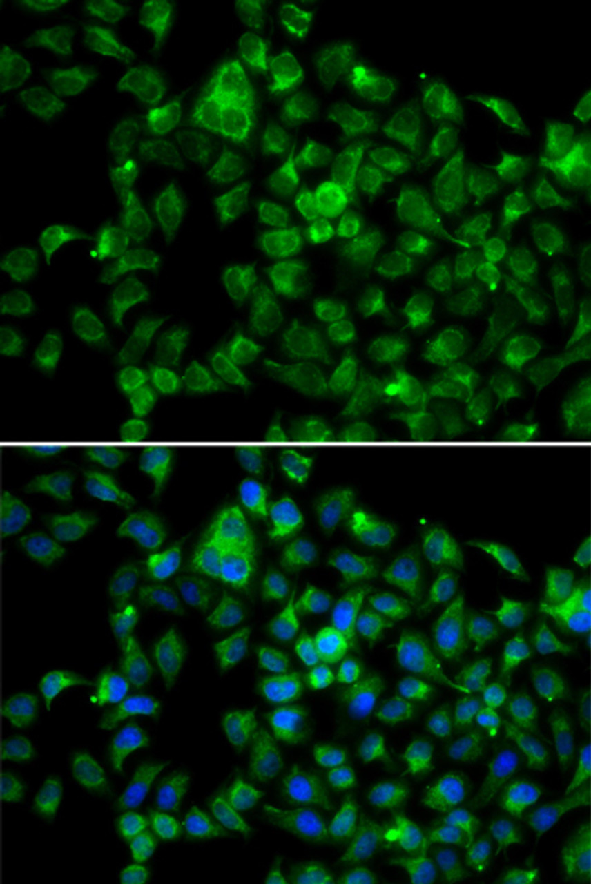 Immunofluorescence analysis of A549 cells using NAT8B Polyclonal Antibody