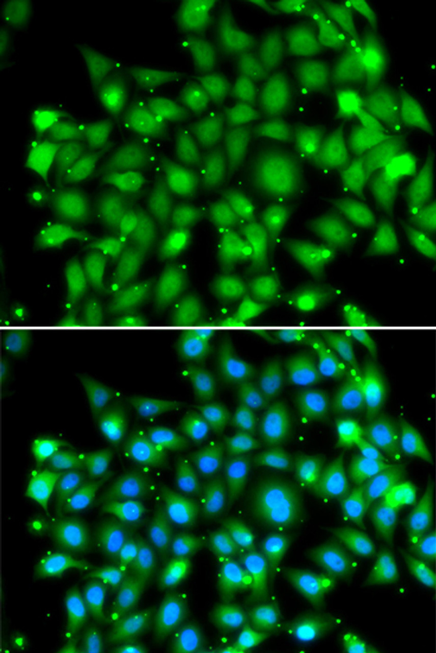 Immunofluorescence analysis of MCF-7 cells using SUFU Polyclonal Antibody