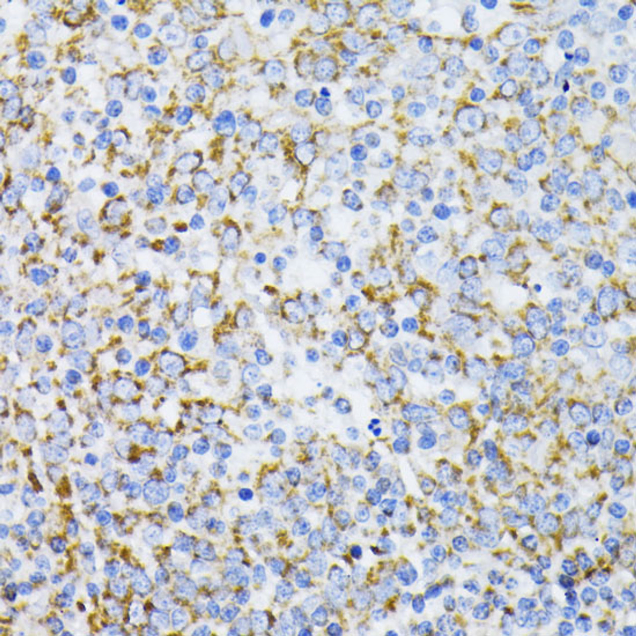 Immunohistochemistry of paraffin-embedded Human tonsil using Cytochrome c Polyclonal Antibody at dilution of  1:100 (40x lens).