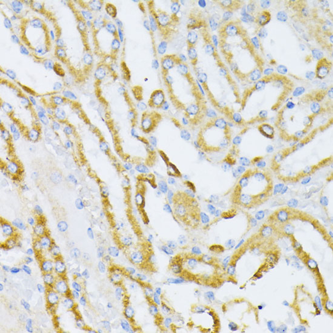 Immunohistochemistry of paraffin-embedded Mouse kidney using Cytochrome c Polyclonal Antibody at dilution of  1:100 (40x lens).