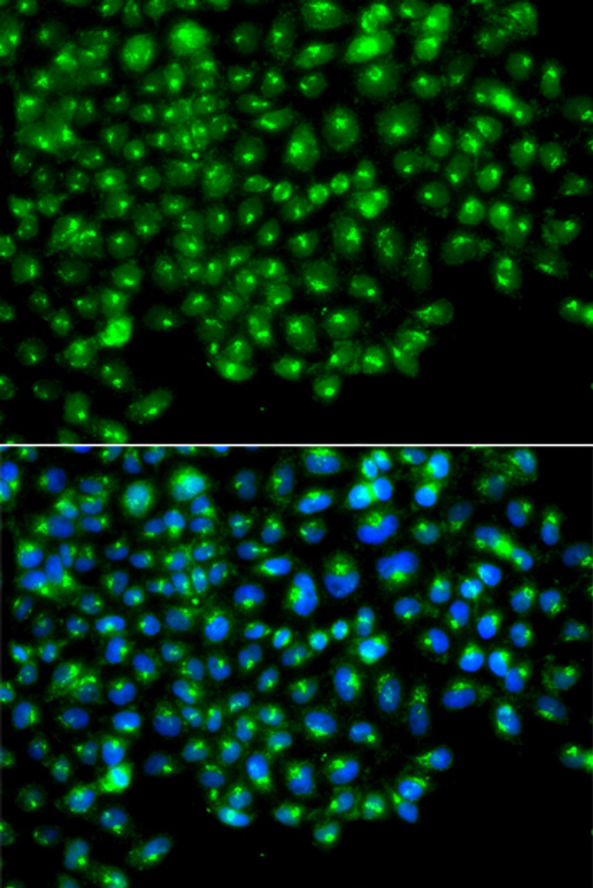 Immunofluorescence analysis of A549 cells using GOPC Polyclonal Antibody
