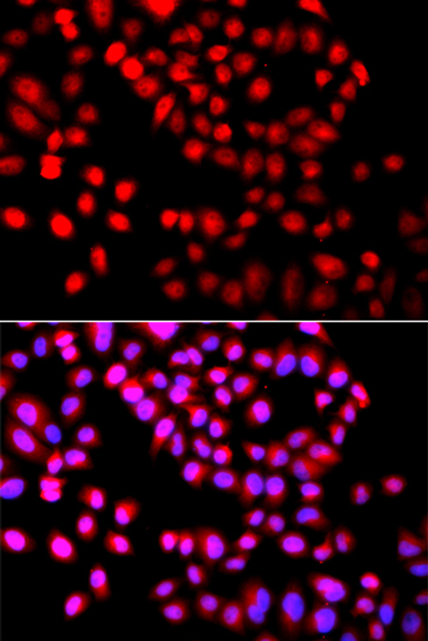 Immunofluorescence analysis of A549 cells using SETD6 Polyclonal Antibody