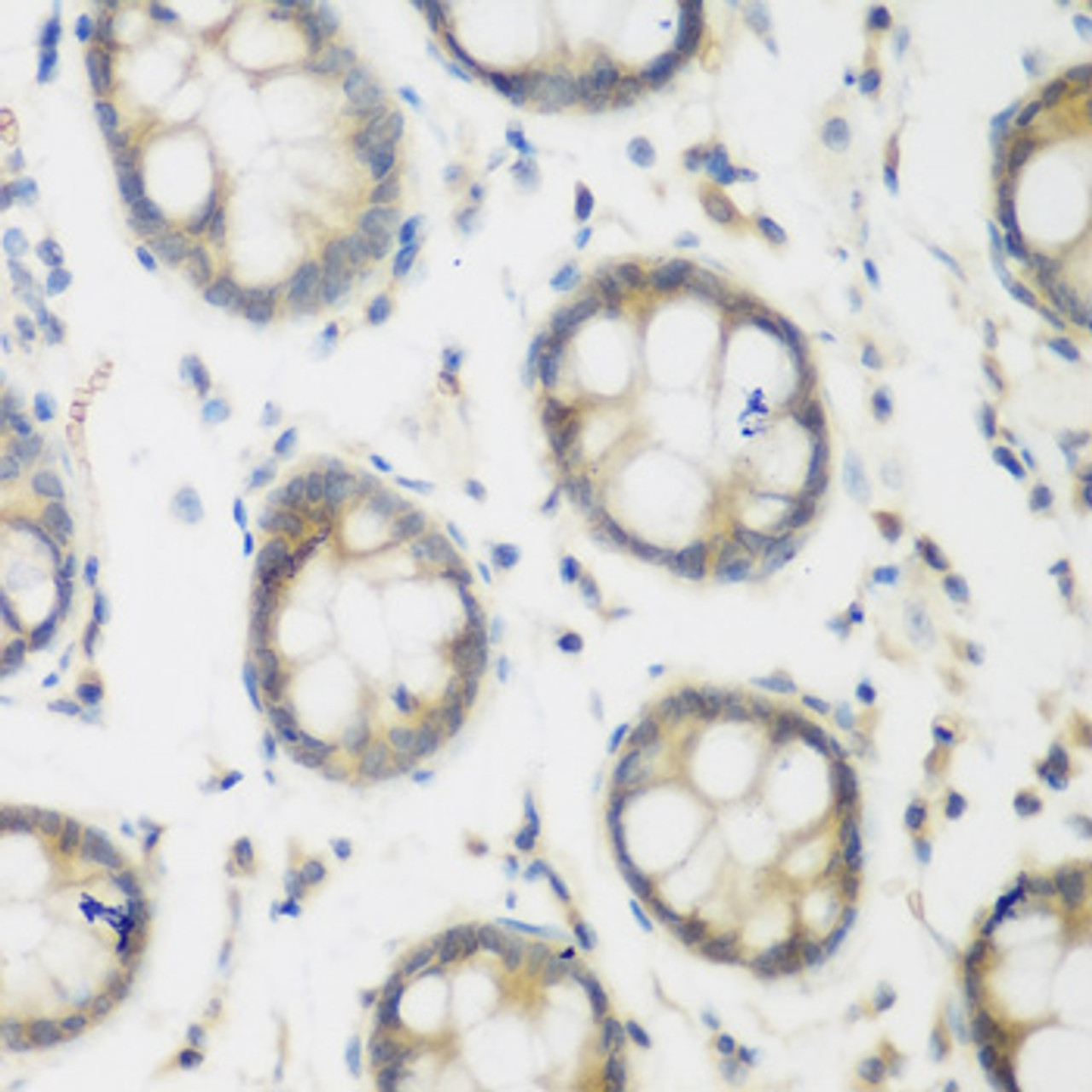 Immunohistochemistry of paraffin-embedded Human colon using ACCS Polyclonal Antibody at dilution of  1:200 (40x lens).