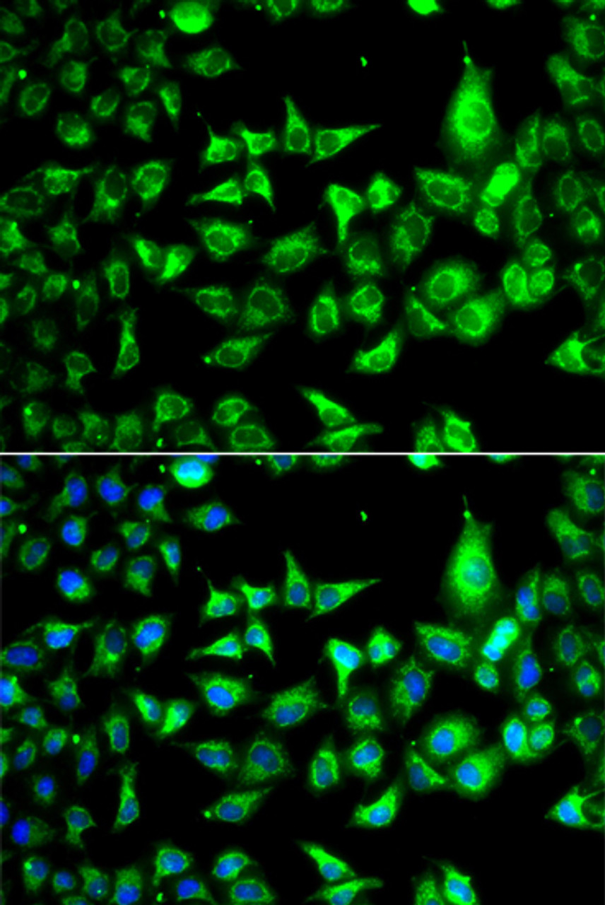 Immunofluorescence analysis of A549 cells using ACCS Polyclonal Antibody