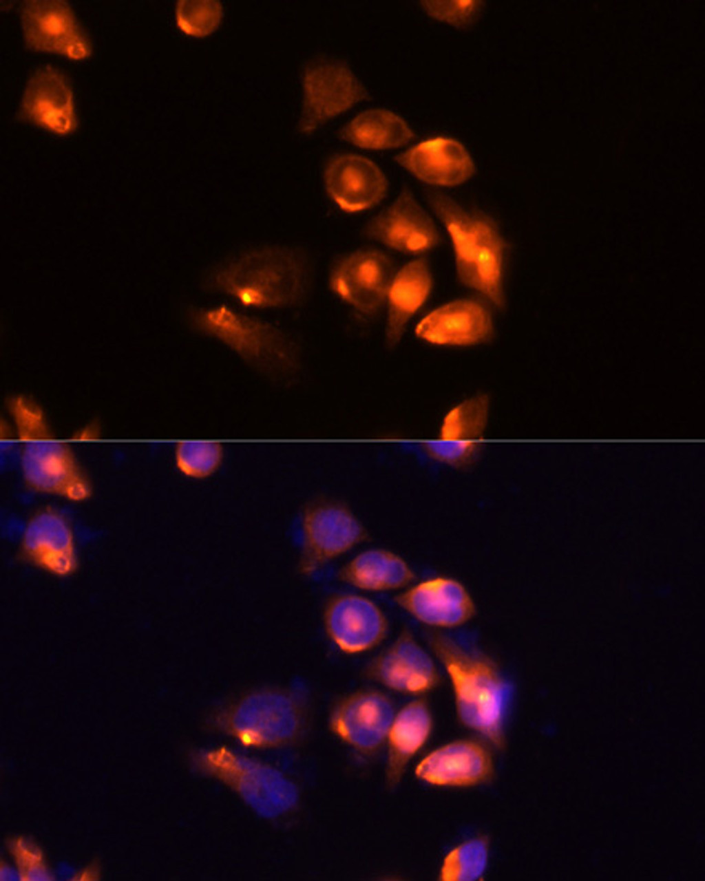 Immunofluorescence analysis of Hela cells using TIM-3/HAVCR2 Polyclonal Antibody at dilution of  1:100 (40x lens). Blue: DAPI for nuclear staining.