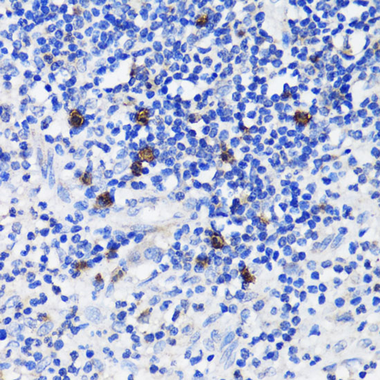 Immunohistochemistry of paraffin-embedded Human appendix using TET3 Polyclonal Antibody at dilution of  1:200 (40x lens).