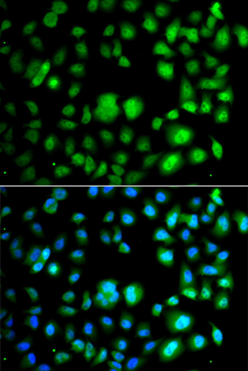 Immunofluorescence analysis of A549 cells using TET3 Polyclonal Antibody