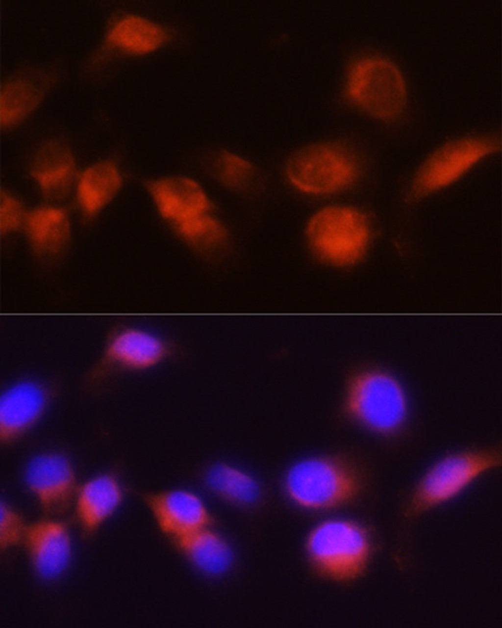 Immunofluorescence analysis of A431 cells using ACPP Polyclonal Antibody at dilution of  1:100 (40x lens). Blue: DAPI for nuclear staining.