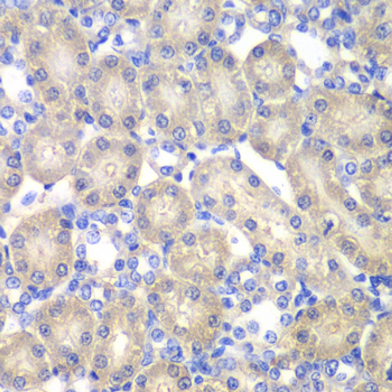 Immunohistochemistry of paraffin-embedded Rat kidney using ACY1 Polyclonal Antibody at dilution of  1:100 (40x lens).