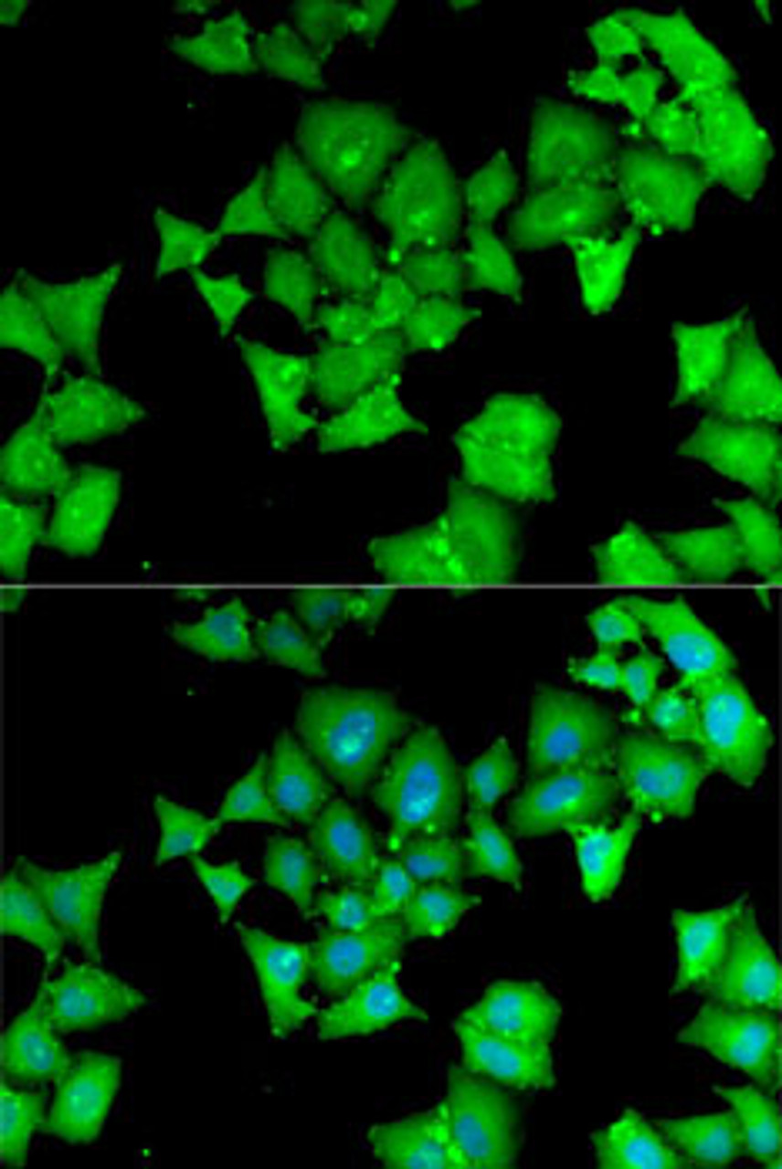 Immunofluorescence analysis of MCF7 cells using ACY1 Polyclonal Antibody