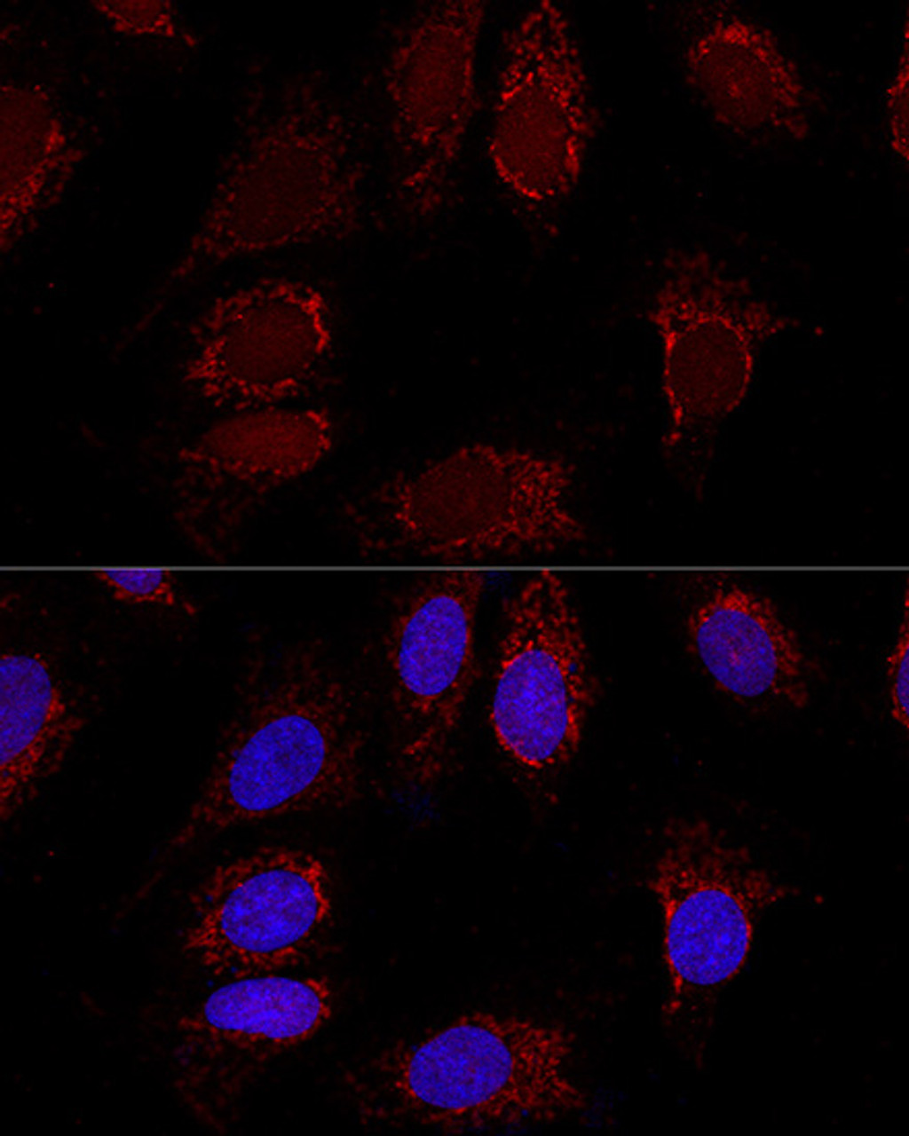 Confocal immunofluorescence analysis of U2OS cells using AK4 Polyclonal Antibody at dilution of  1:100. Blue: DAPI for nuclear staining.