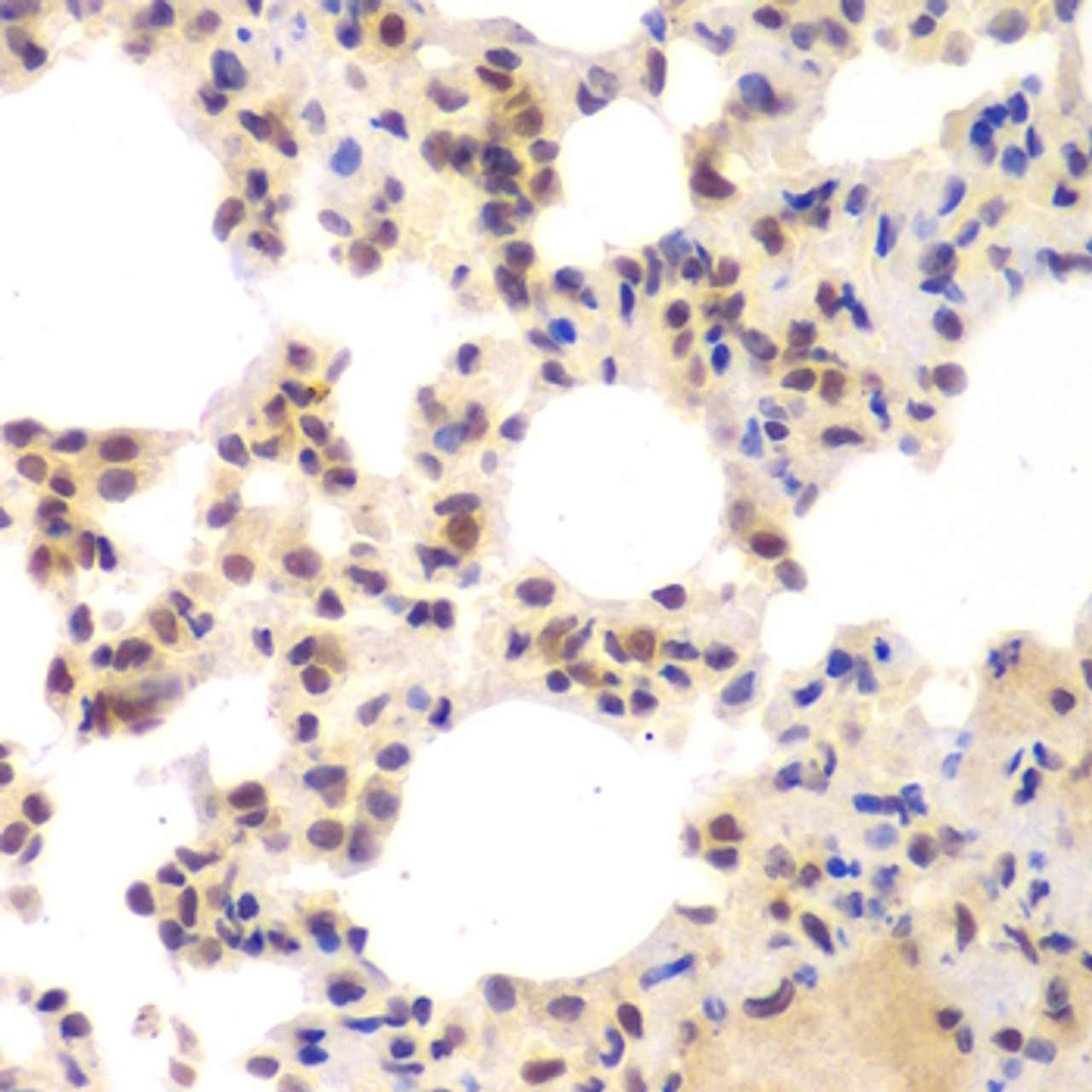 Immunohistochemistry of paraffin-embedded Mouse lung using CSNK2A2 Polyclonal Antibody at dilution of  1:100 (40x lens).