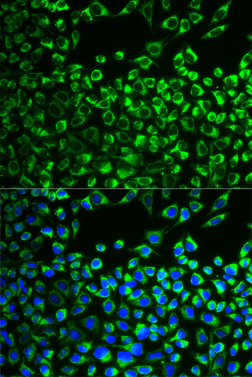 Immunofluorescence analysis of MCF-7 cells using CYP51A1 Polyclonal Antibody