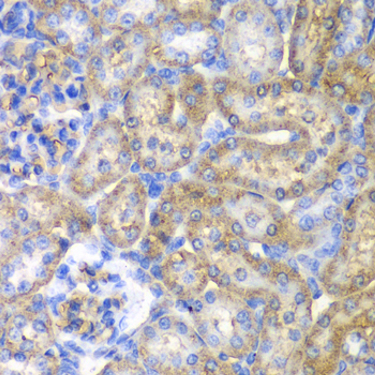 Immunohistochemistry of paraffin-embedded Rat kidney using EHHADH Polyclonal Antibody at dilution of  1:100 (40x lens).