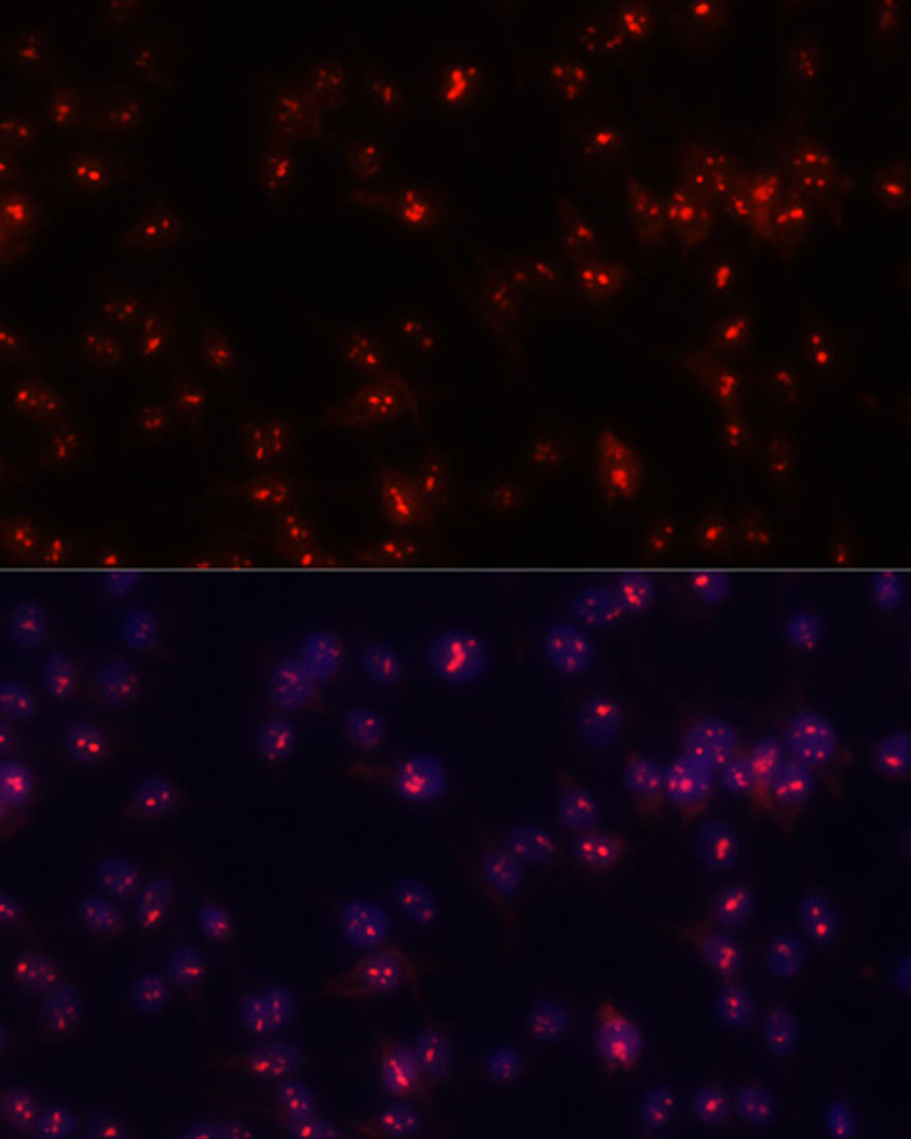 Immunofluorescence analysis of C6 cells using FBL Polyclonal Antibody at dilution of  1:100. Blue: DAPI for nuclear staining.