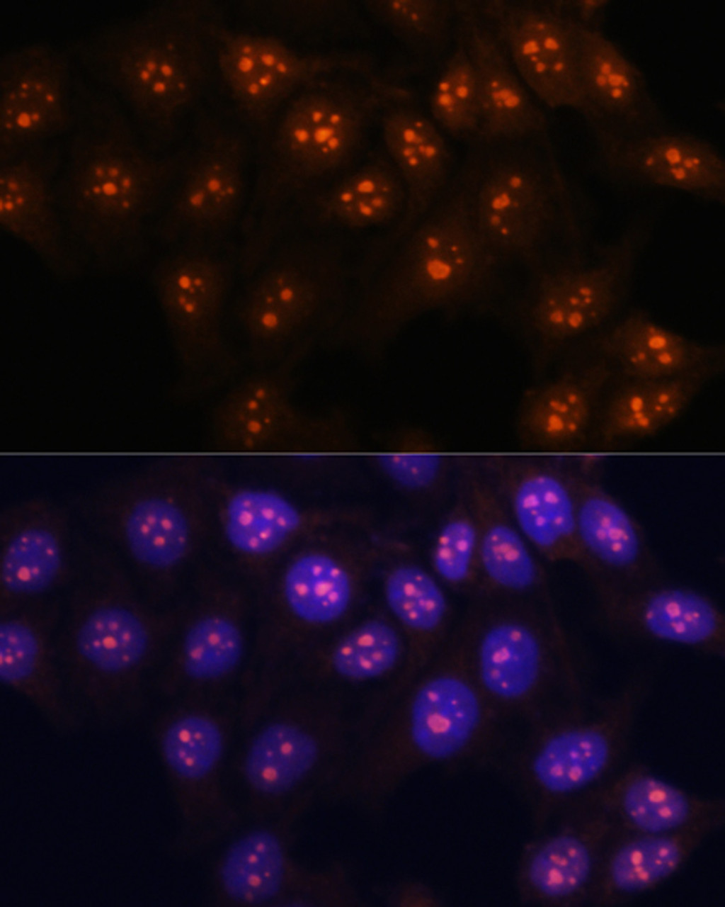 Immunofluorescence analysis of HeLa cells using FBL Polyclonal Antibody at dilution of  1:100. Blue: DAPI for nuclear staining.