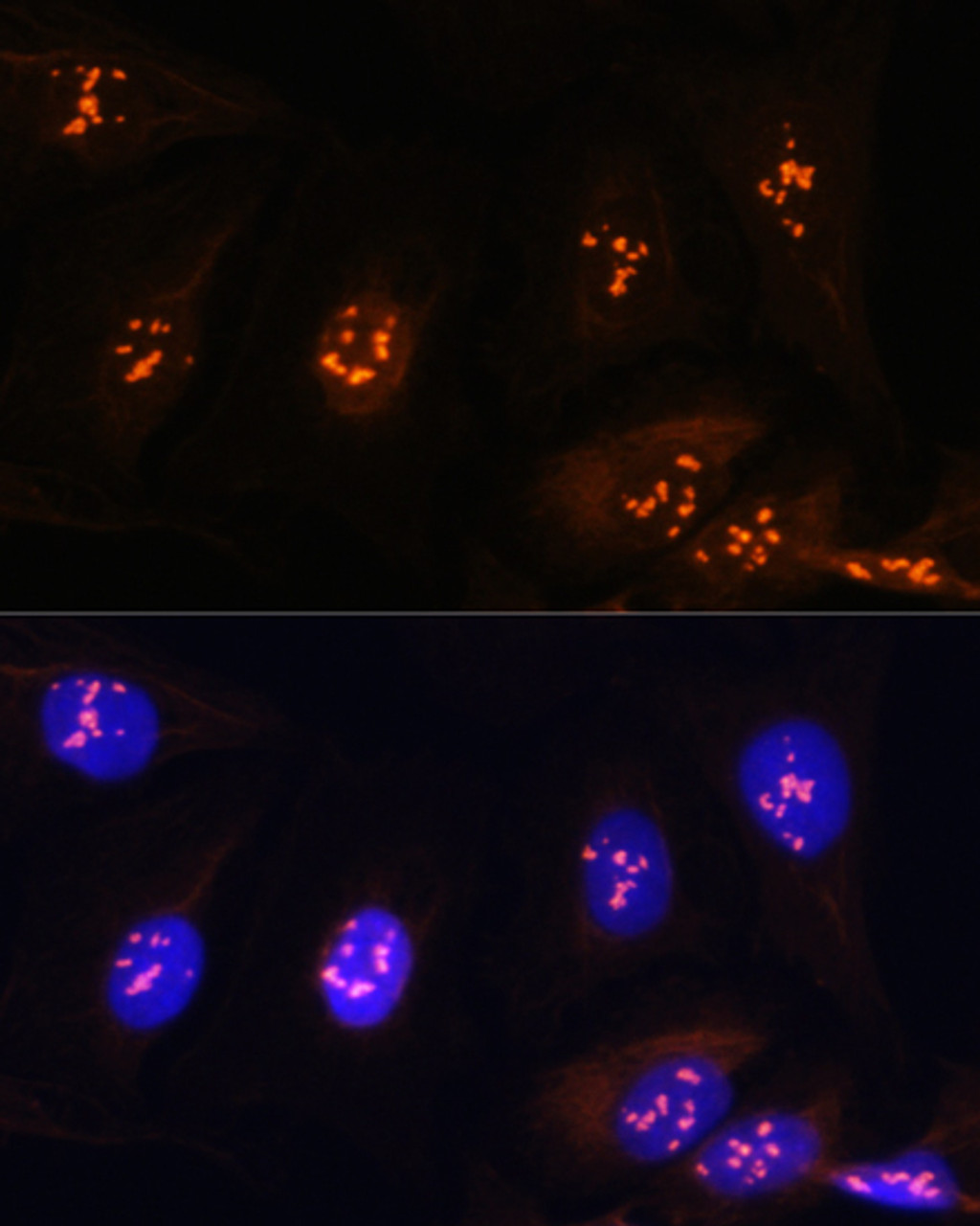 Immunofluorescence analysis of U2OS cells using FBL Polyclonal Antibody at dilution of  1:100. Blue: DAPI for nuclear staining.