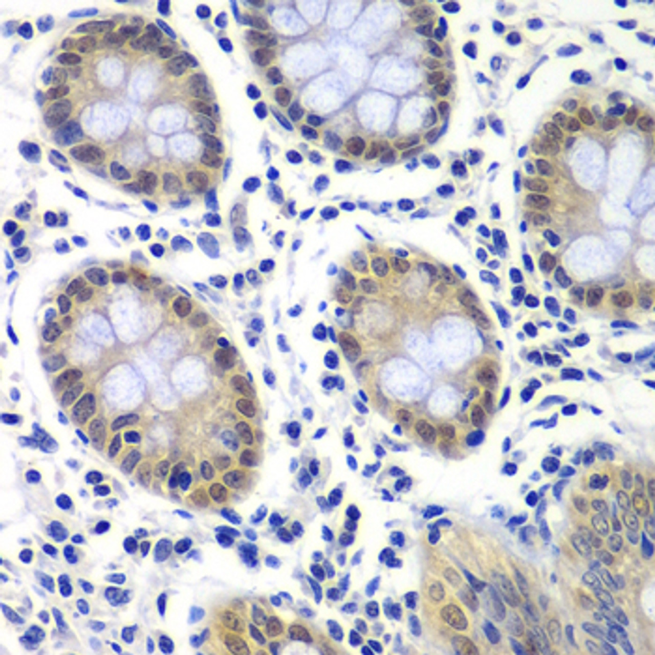 Immunohistochemistry of paraffin-embedded Human colon using GTF2F2 Polyclonal Antibody at dilution of  1:200 (40x lens).