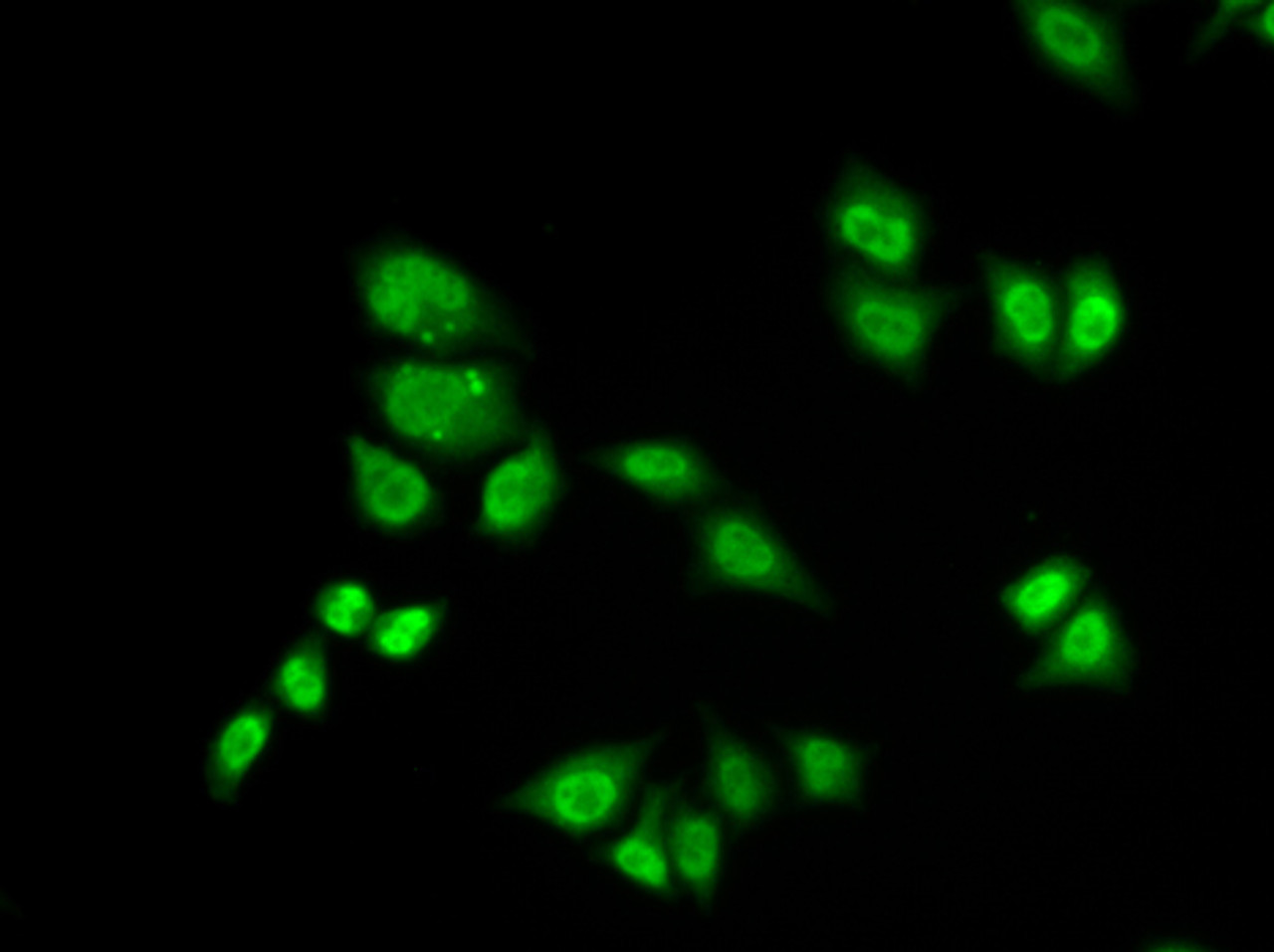 Immunofluorescence analysis of A549 cells using GTF2F2 Polyclonal Antibody