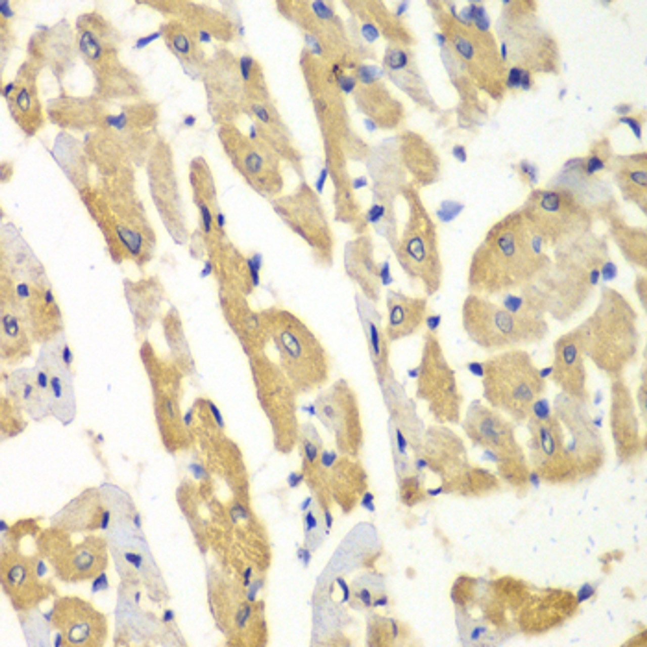 Immunohistochemistry of paraffin-embedded Mouse heart using HNMT Polyclonal Antibody at dilution of  1:100 (40x lens).