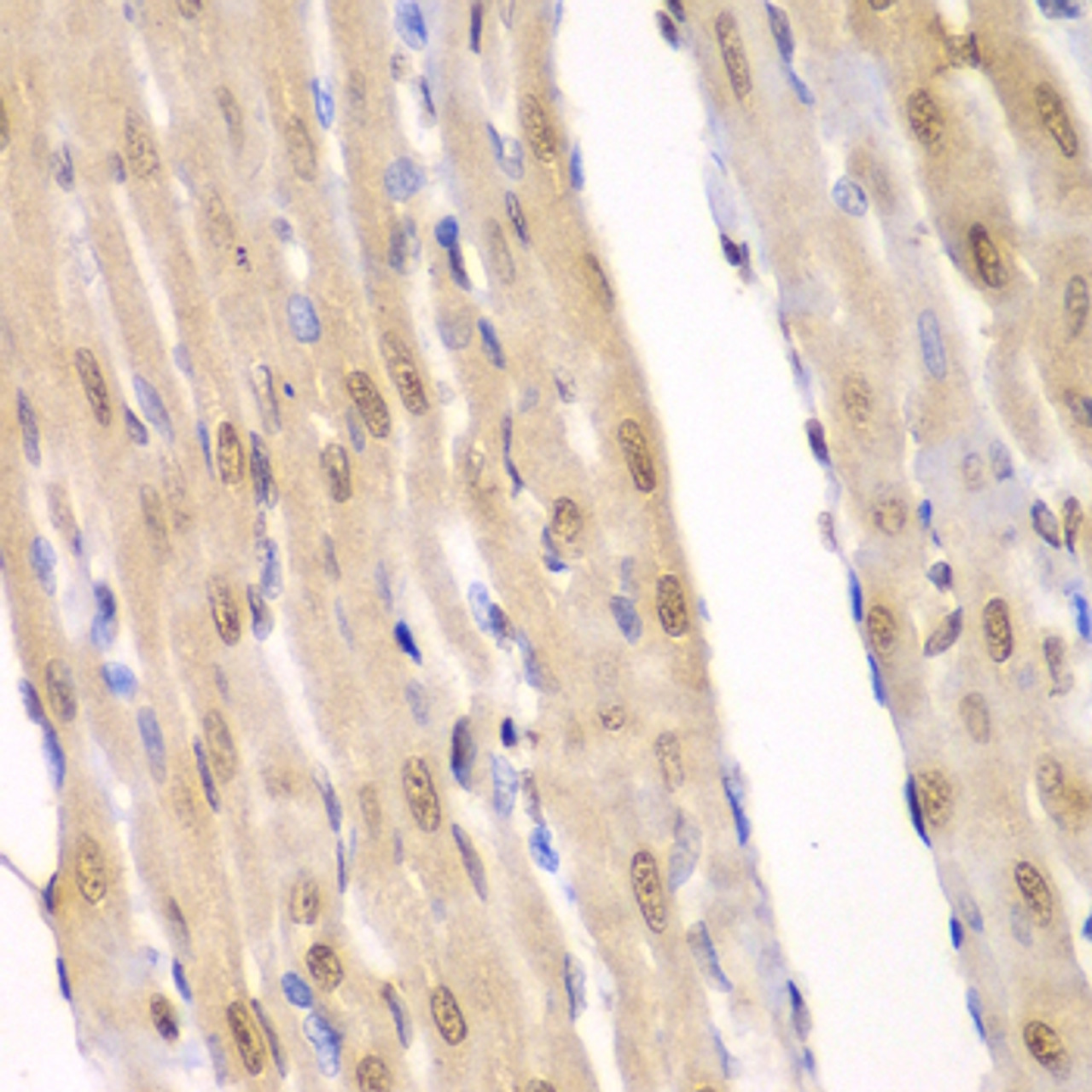 Immunohistochemistry of paraffin-embedded Rat heart using LIG3 Polyclonal Antibody at dilution of  1:100 (40x lens).