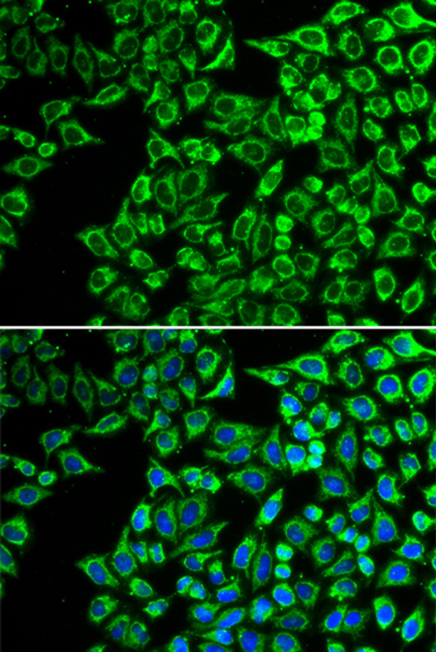 Immunofluorescence analysis of A549 cells using LIPC Polyclonal Antibody