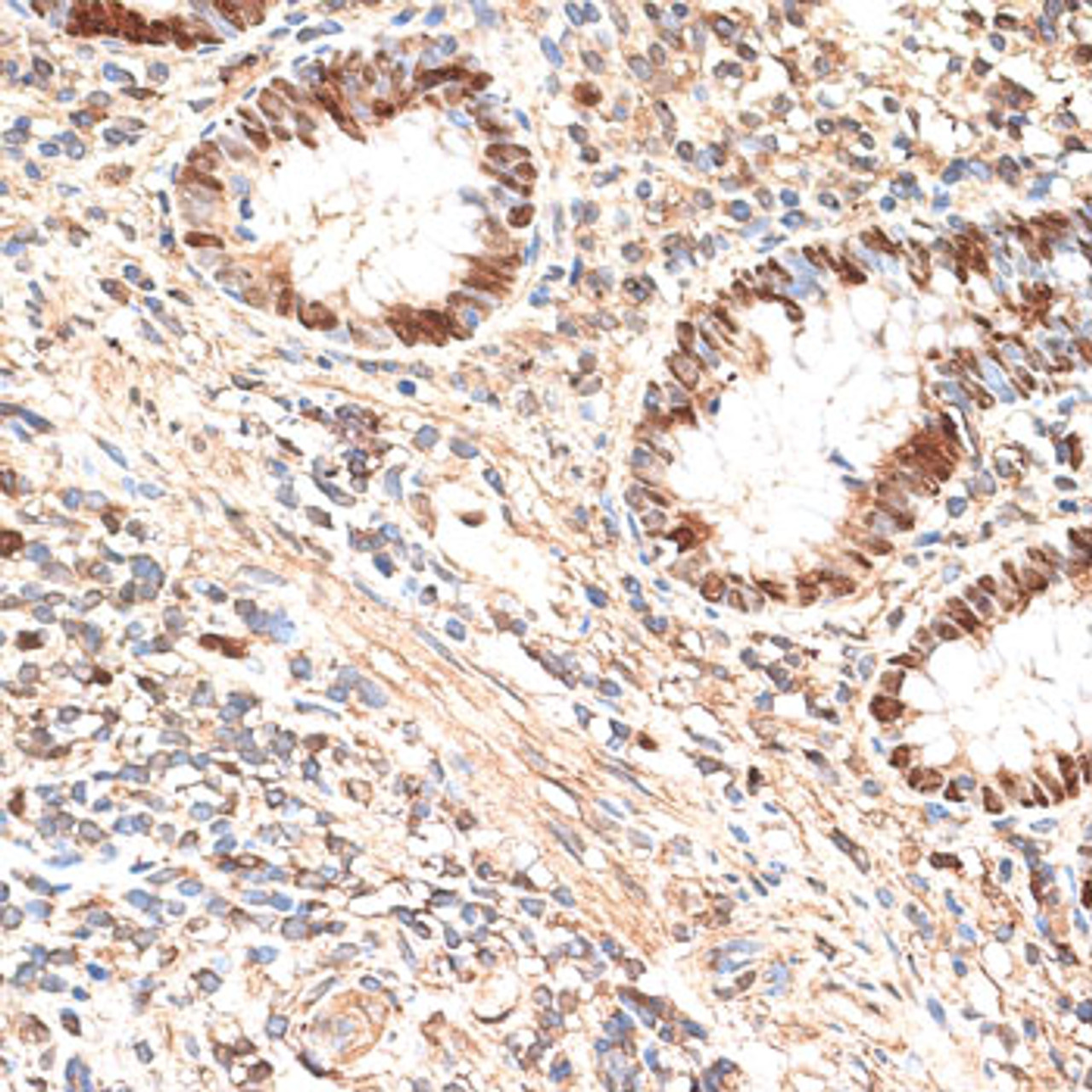 Immunohistochemistry of paraffin-embedded Human appendix using MCM5 Polyclonal Antibody at dilution of  1:100 (40x lens).