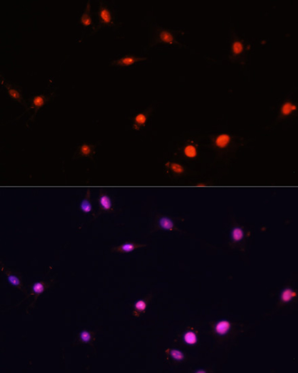 Immunofluorescence analysis of C6 cells using MCM5 Polyclonal Antibody at dilution of  1:100. Blue: DAPI for nuclear staining.