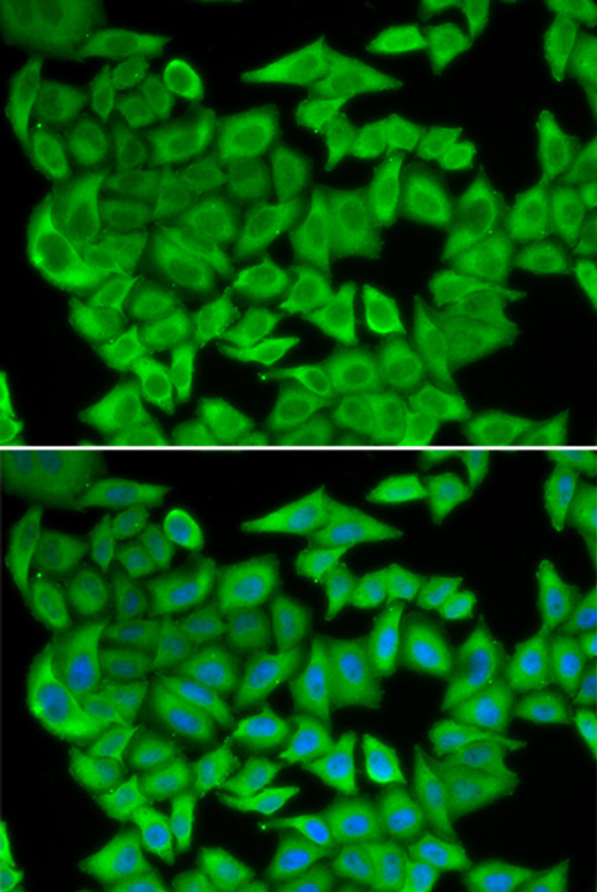 Immunofluorescence analysis of U2OS cells using MDH2 Polyclonal Antibody