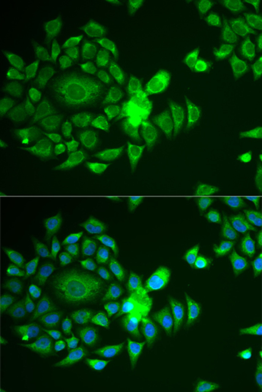 Immunofluorescence analysis of U2OS cells using NDUFS4 Polyclonal Antibody