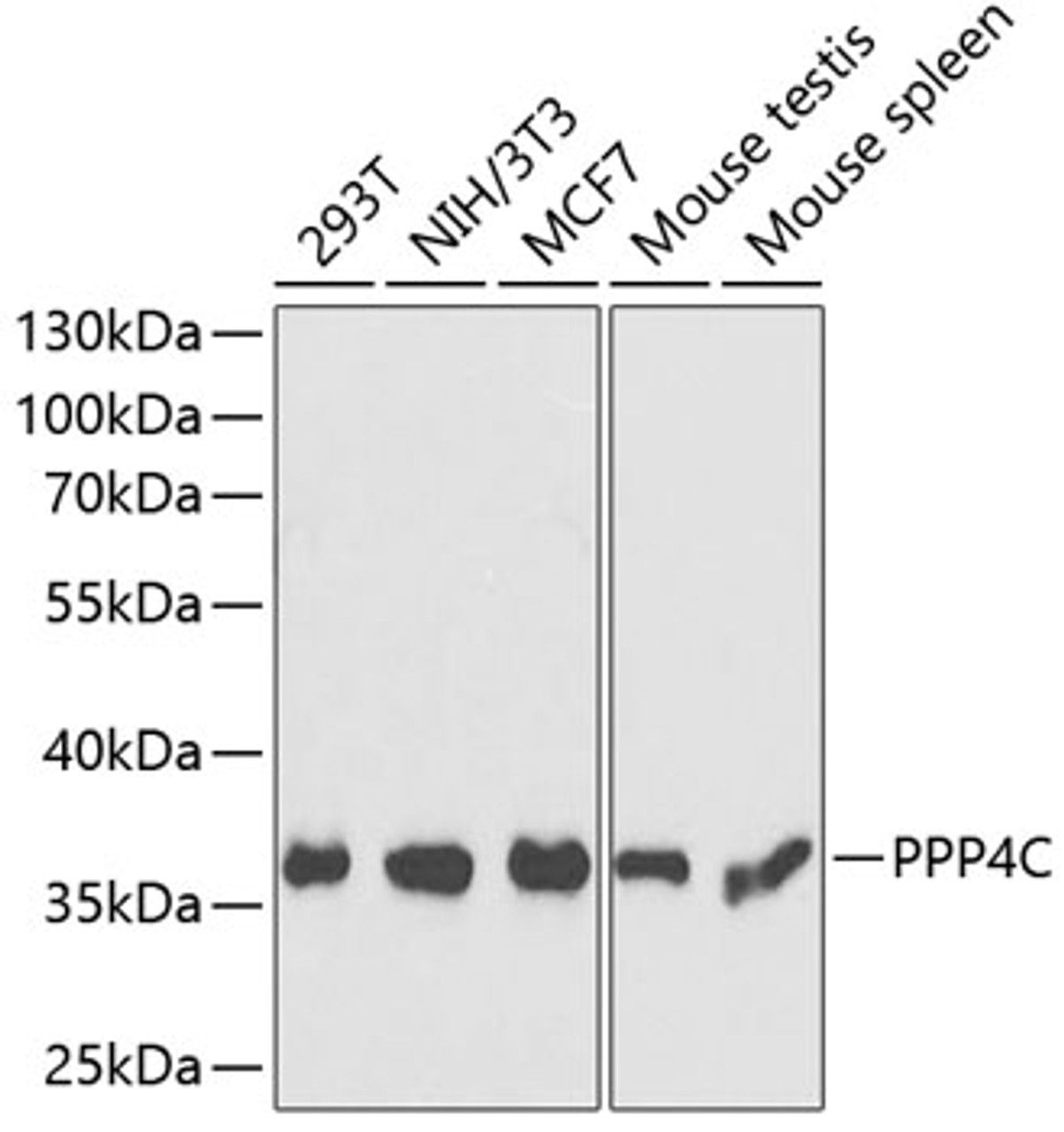 Western blot analysis of extracts of various cell lines using PPP4C Polyclonal Antibody at dilution of 1:1000.