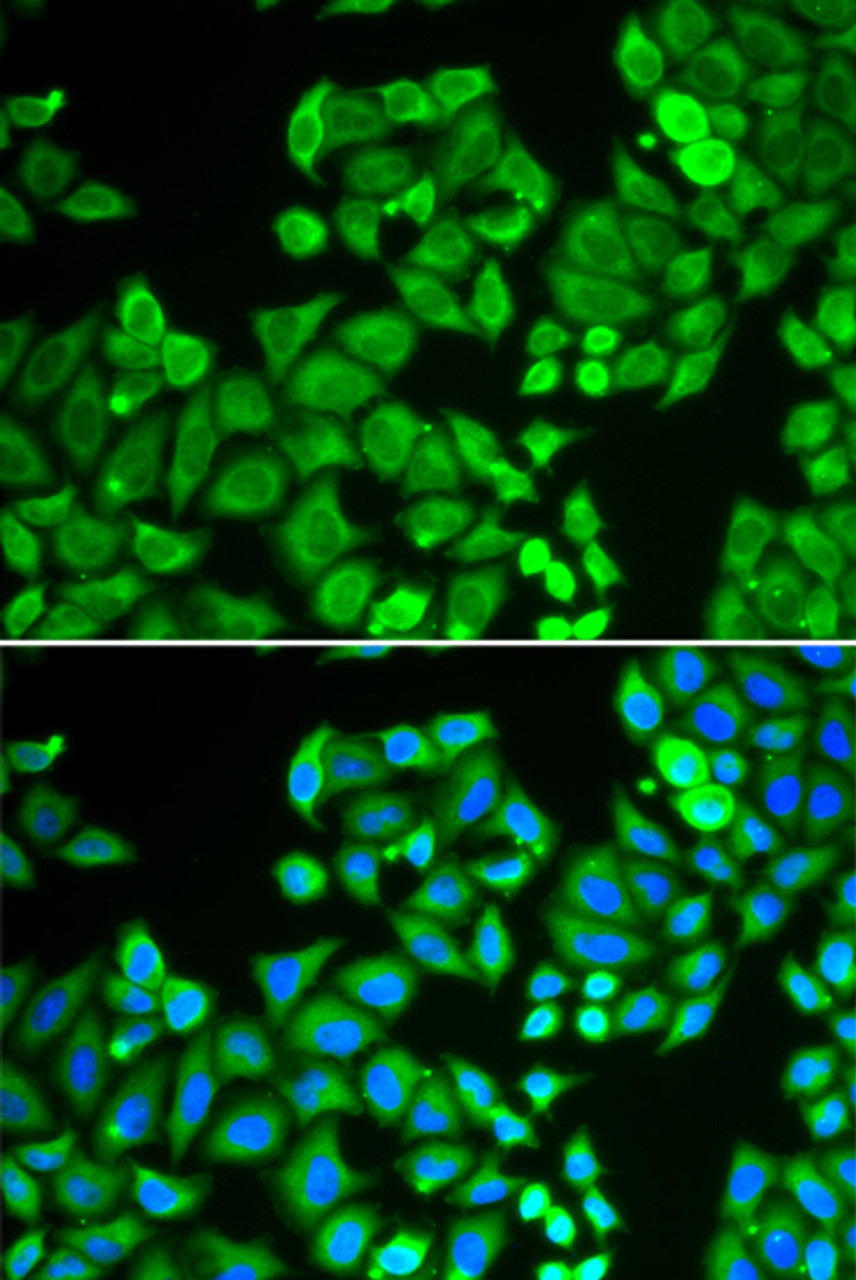 Immunofluorescence analysis of U2OS cells using PPP4C Polyclonal Antibody