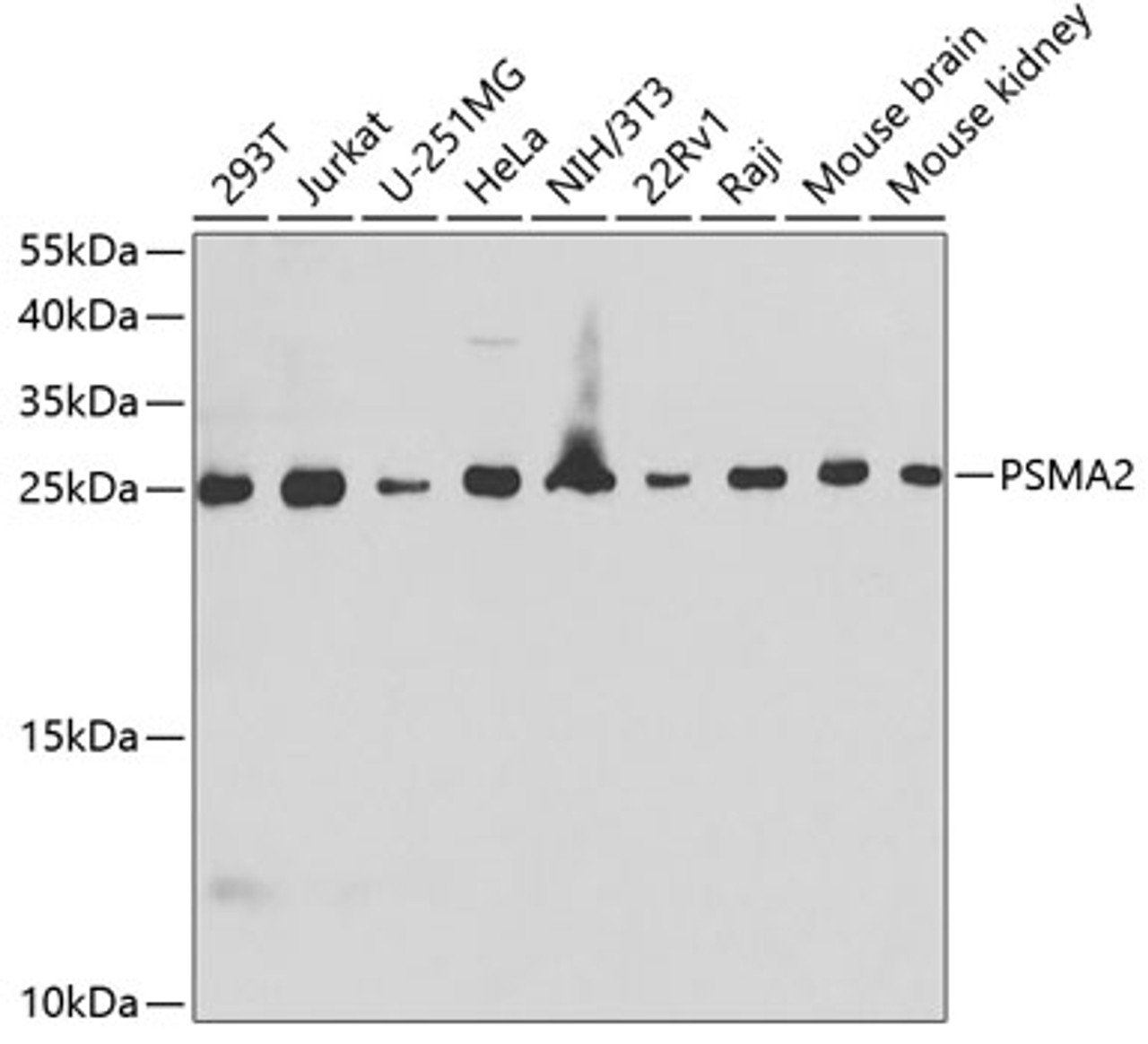 Western blot analysis of extracts of various cell lines using PSMA2 Polyclonal Antibody at dilution of 1:1000.