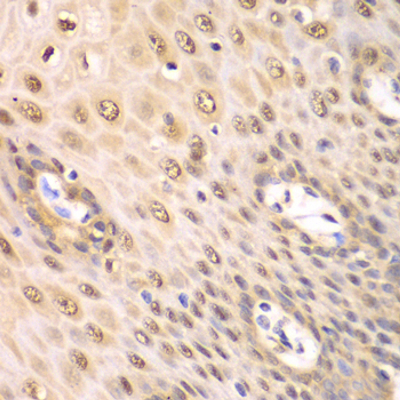 Immunohistochemistry of paraffin-embedded Human esophagus using PSMA2 Polyclonal Antibody at dilution of  1:100 (40x lens).
