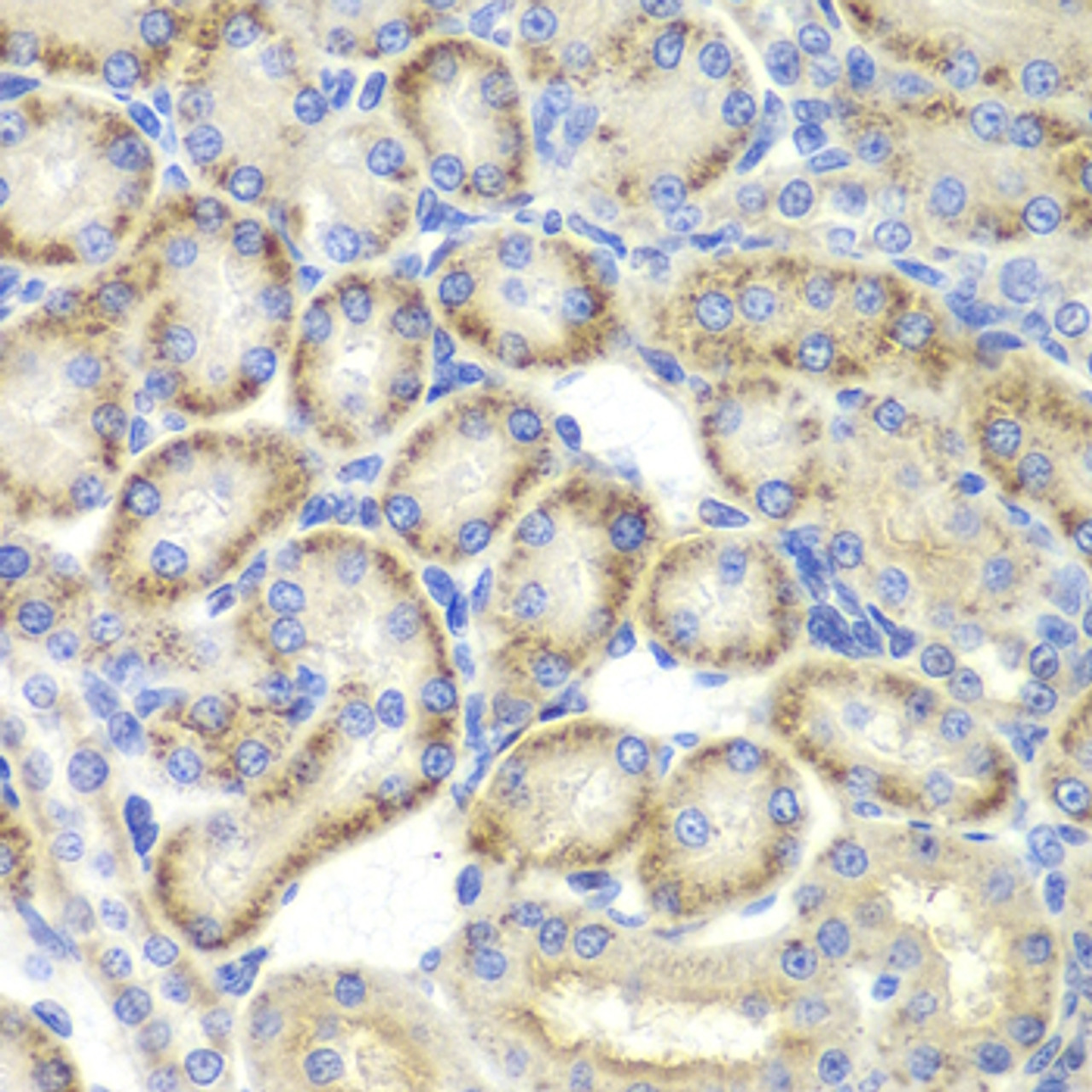 Immunohistochemistry of paraffin-embedded Rat kidney using ST3GAL4 Polyclonal Antibody at dilution of  1:200 (40x lens).