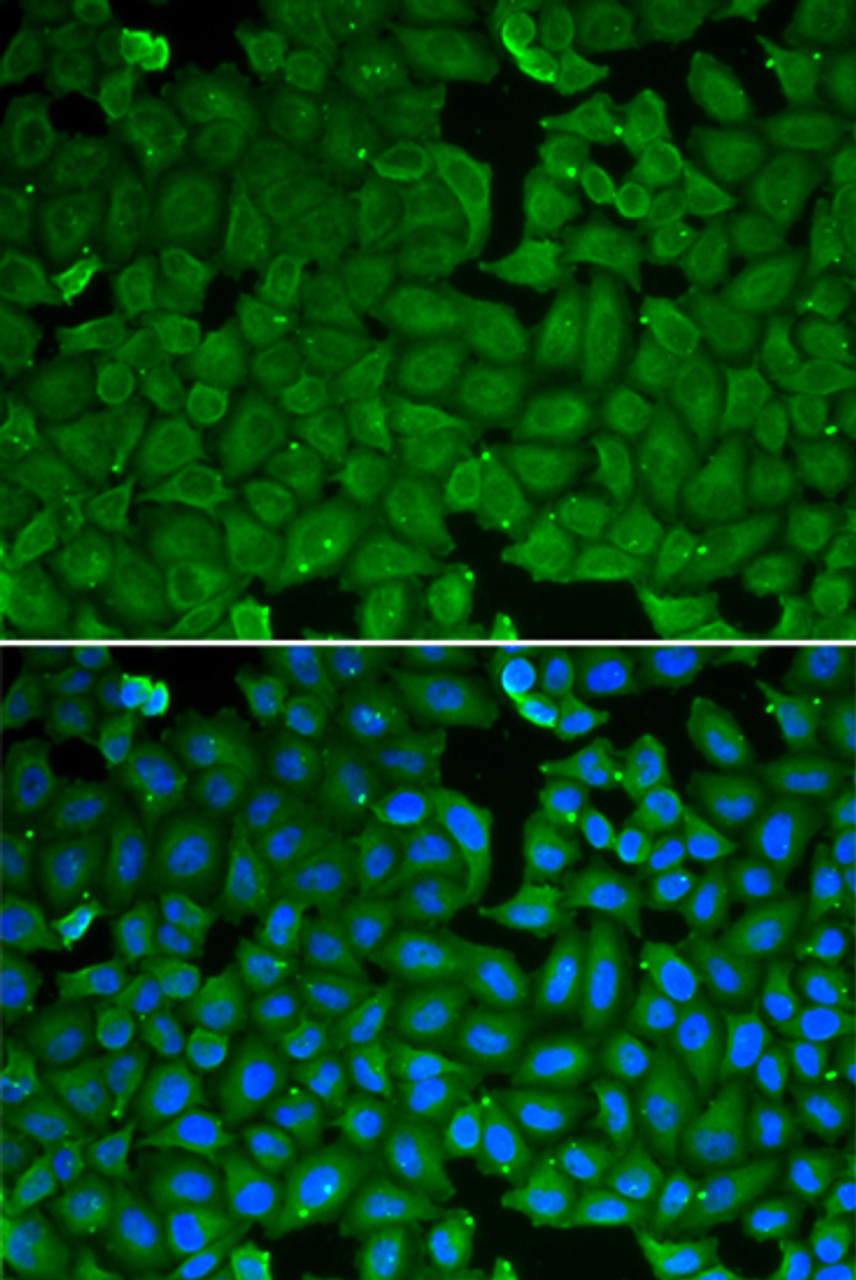 Immunofluorescence analysis of HeLa cells using SPINK1 Polyclonal Antibody