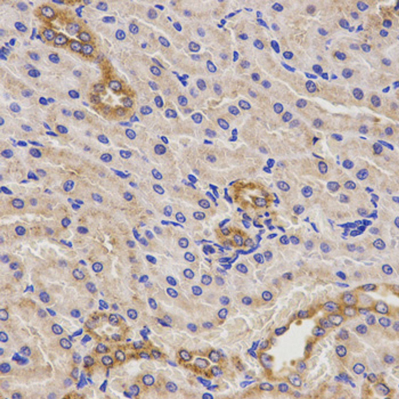 Immunohistochemistry of paraffin-embedded Rat kidney using TNFRSF1B Polyclonal Antibody at dilution of  1:200 (40x lens).