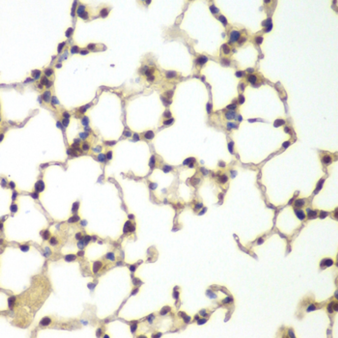 Immunohistochemistry of paraffin-embedded Mouse lung using USF1 Polyclonal Antibody at dilution of  1:200 (40x lens).