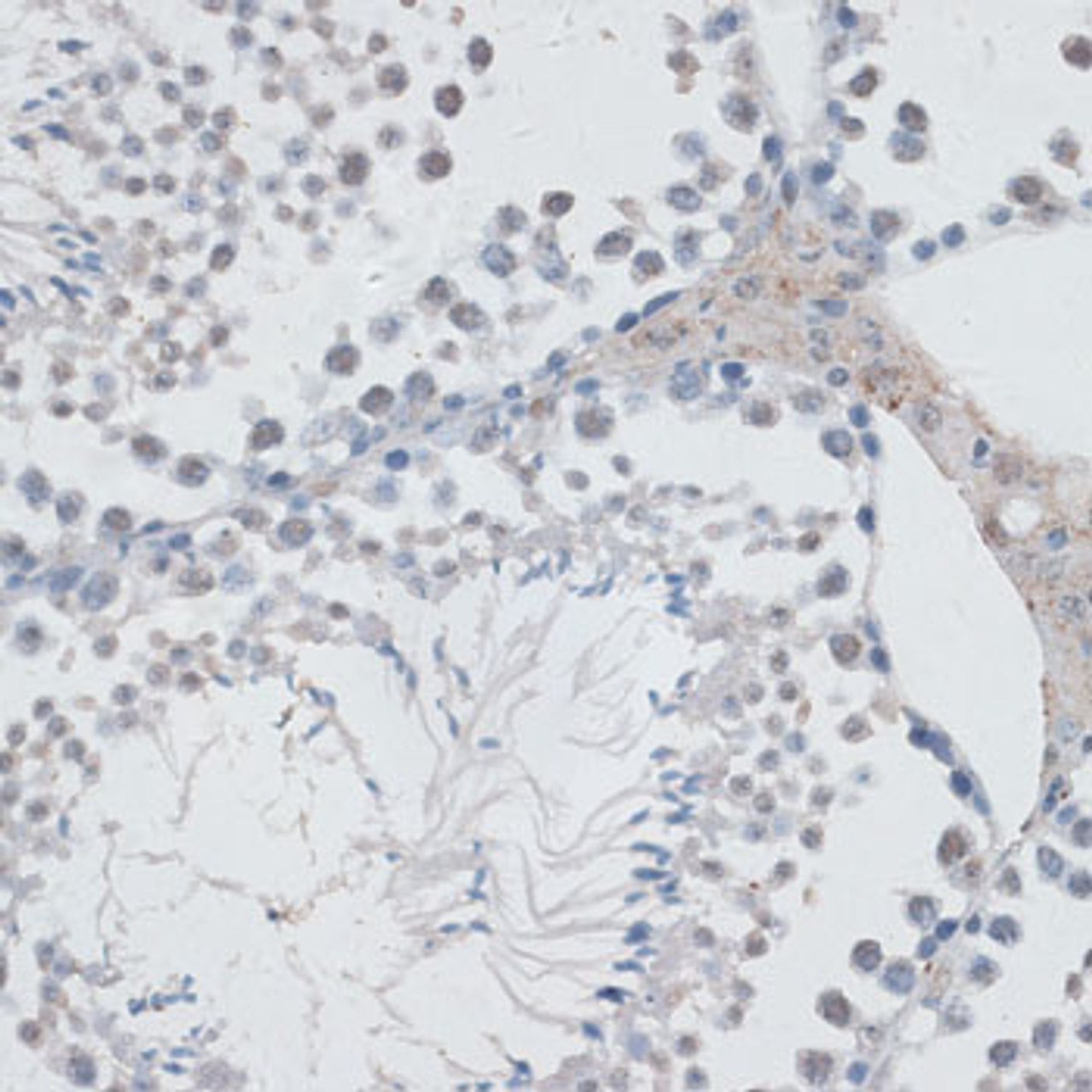 Immunohistochemistry of paraffin-embedded Mouse testis using USP7 Polyclonal Antibody at dilution of  1:100 (40x lens).