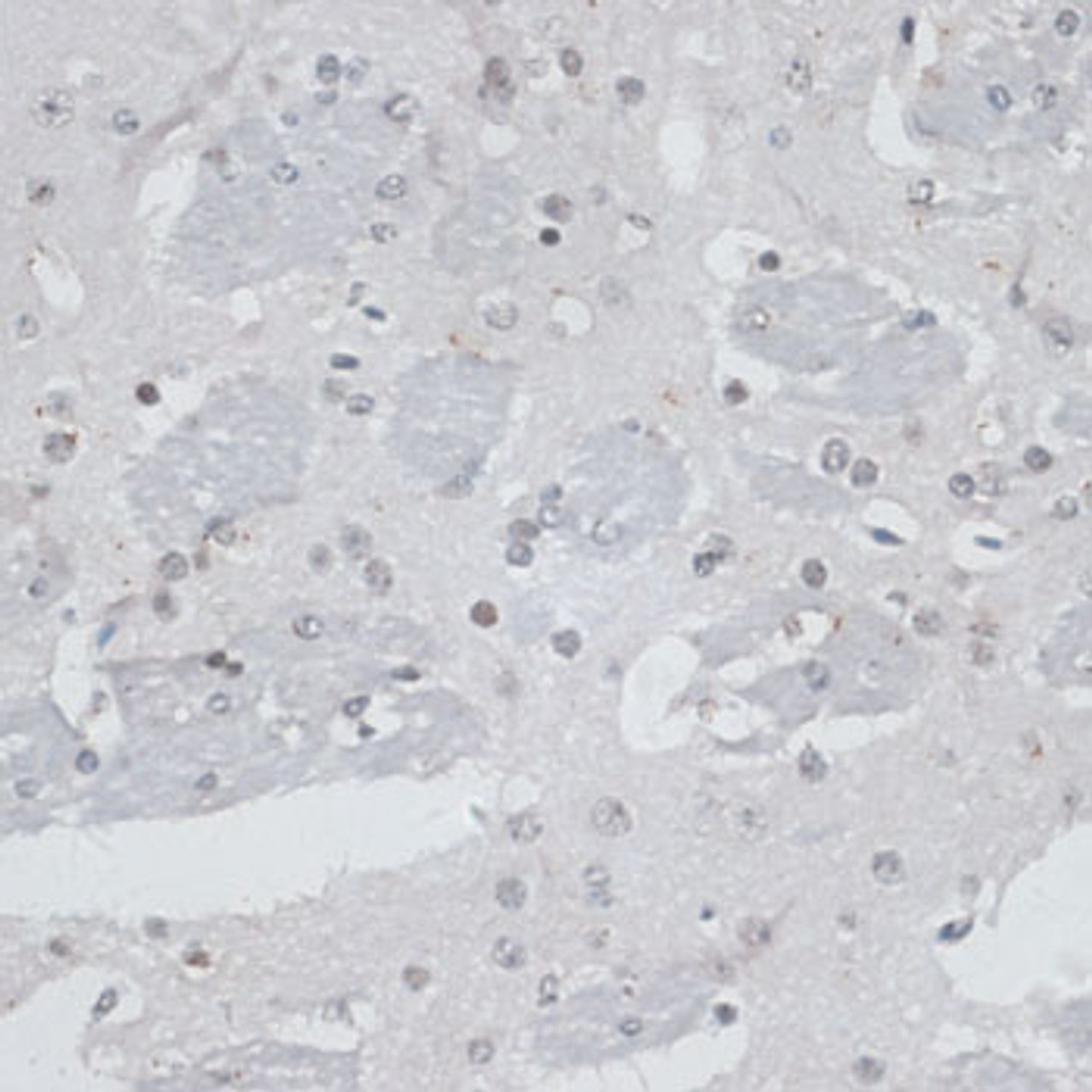 Immunohistochemistry of paraffin-embedded Mouse brain using USP7 Polyclonal Antibody at dilution of  1:100 (40x lens).