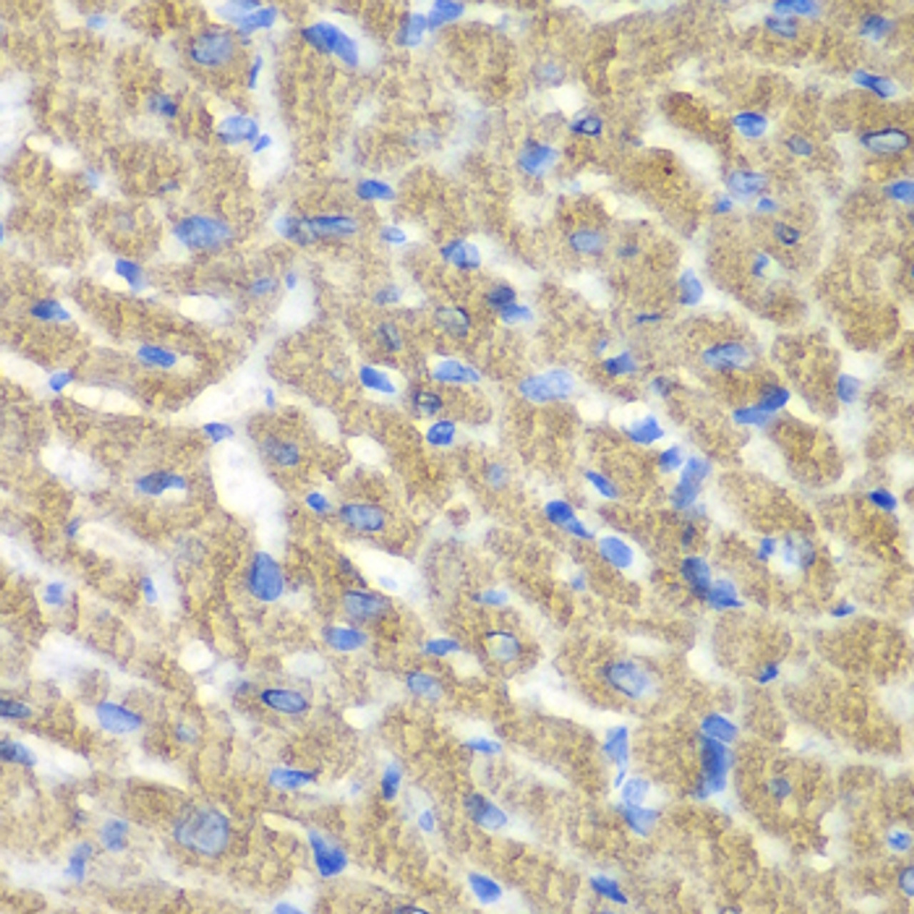 Immunohistochemistry of paraffin-embedded Mouse heart using FIBP Polyclonal Antibody at dilution of  1:100 (40x lens).