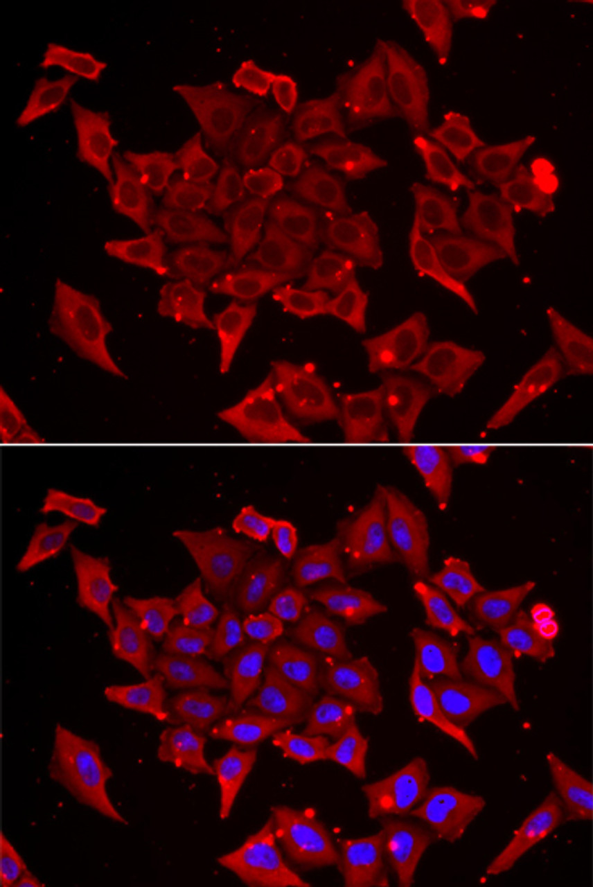 Immunofluorescence analysis of U2OS cells using TIMM17A Polyclonal Antibody