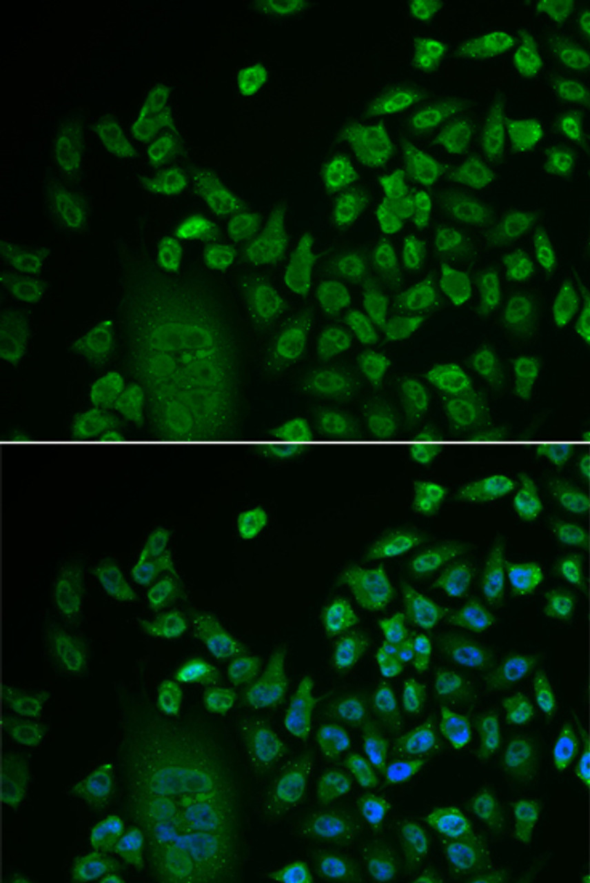 Immunofluorescence analysis of HeLa cells using LSM4 Polyclonal Antibody at dilution of  1:50. Blue: DAPI for nuclear staining.